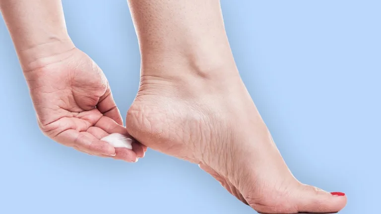 Como eliminar rachaduras dos pés usando aspirina e vaselina