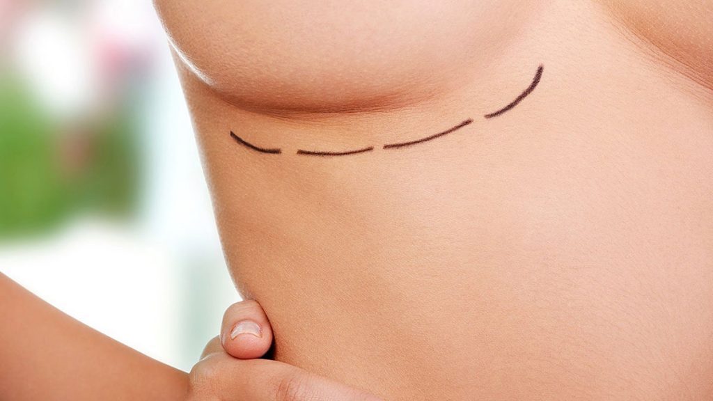 Lista traz seis plantas popularmente reconhecidas por aumentar os seios de forma natural e sem agredir o corpo, como no caso de uso de silicone.